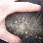 10 Scary Causes of Dog Dandruff: Effective Treatment Strategies