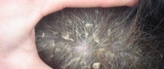 10 Scary Causes of Dog Dandruff: Effective Treatment Strategies