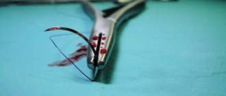 how to remove stitches from a dog: features of suture material